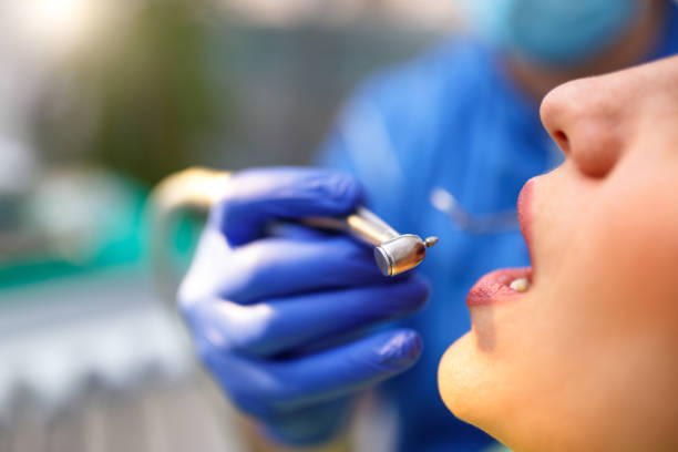 Best Veneers and Lumineers  in San Martin, CA